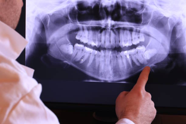 Best Emergency Dental Extractions in Linton Hall, VA